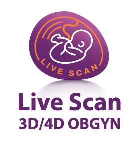 Live scan
